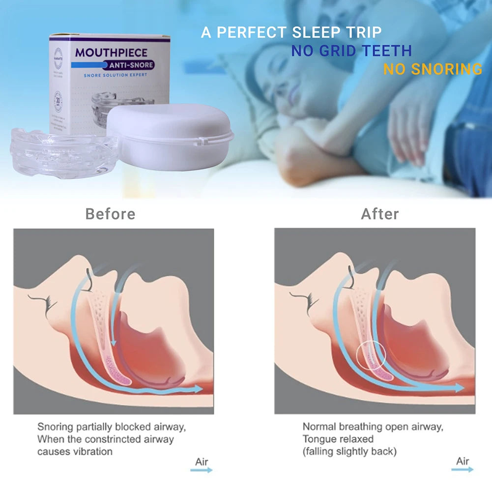 FREE SHIPPING! The Ultimate Anti-Snoring Solution – No CPAP Needed!